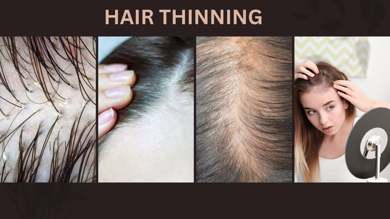 Hair Thinning