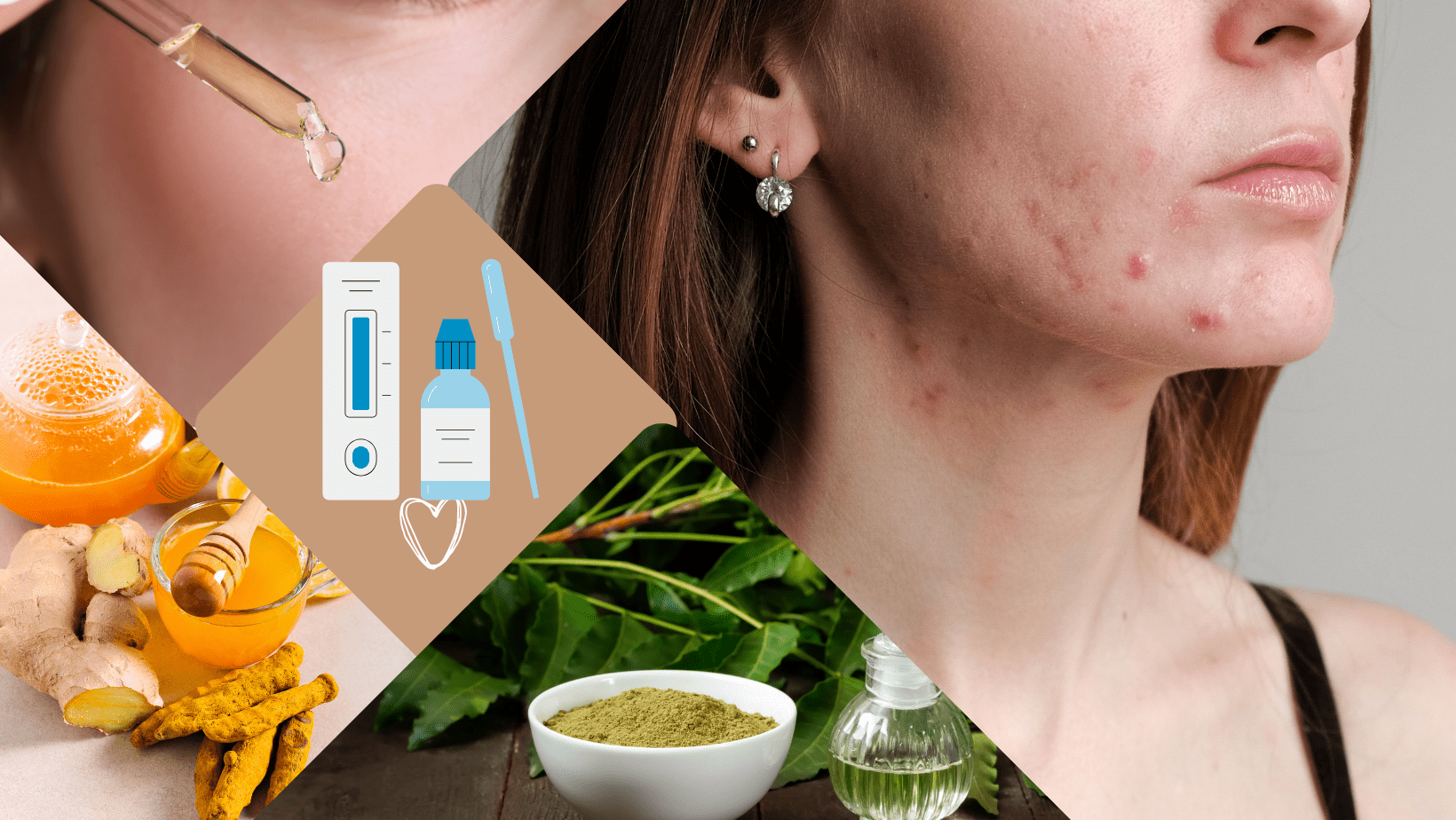 .Navigating Makeup Allergies and Irritations: Causes, Ayurvedic Remedies, and Gentle Natural Alternatives