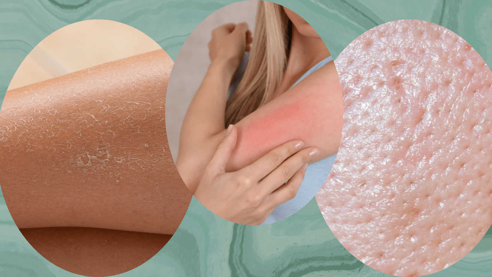 Suitability for Different Skin Types